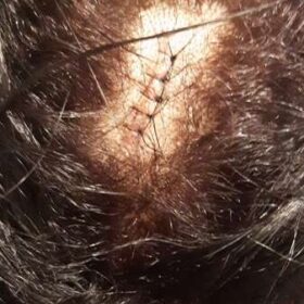Investigadores prendem homem que tentou matar ex-esposa em Sarandi Foto 3 Fotos de Investigadores prendem homem que tentou matar ex-esposa em Sarandi