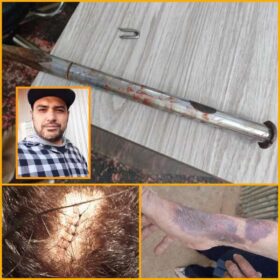 Investigadores prendem homem que tentou matar ex-esposa em Sarandi Foto 4 Fotos de Investigadores prendem homem que tentou matar ex-esposa em Sarandi