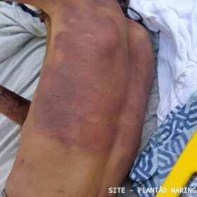 Homem é torturado e cortado com golpes de facão em Paiçandu Foto 8 Fotos de Homem é torturado e cortado com golpes de facão em Paiçandu