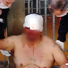Homem é brutalmente agredido com pedradas na cabeça em Maringá Foto 3 Fotos de Homem é brutalmente agredido com pedradas na cabeça em Maringá