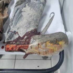 Trabalhador é resgatado após ficar com pé preso em caminhão betoneira em Maringá Foto 14 Fotos de Trabalhador é resgatado após ficar com pé preso em caminhão betoneira em Maringá
