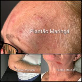 Fotos de Idosa de 72 anos é covardemente agredida durante roubo a residência em Maringá 