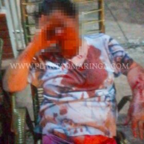 Idosa é agredida e roubada pelo neto ao negar dar dinheiro para ele em Maringá Foto 4 Fotos de Idosa é agredida e roubada pelo neto ao negar dar dinheiro para ele em Maringá