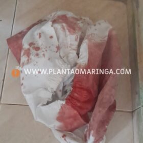 Homem sofre duas tentativas de homicídio em um único dia em Maringá Foto 5 Fotos de Homem sofre duas tentativas de homicídio em um único dia em Maringá