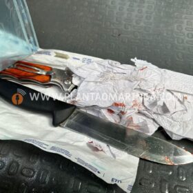 Mulher é atacada e ferida com 7 facadas pelo ex-companheiro em Sarandi; Homem tentou suicídio Foto 14 Fotos de Mulher é atacada e ferida com 7 facadas pelo ex-companheiro em Sarandi; Homem tentou suicídio