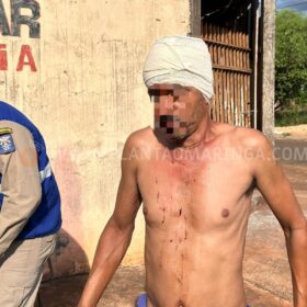 Homem é agredido com golpes de foice em Sarandi Foto 4 Fotos de Homem é agredido com golpes de foice em Sarandi