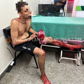 Jovem é baleado em frente à casa da mãe em Maringá Foto 3 Fotos de Jovem é baleado em frente à casa da mãe em Maringá