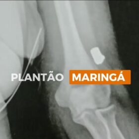 No Sarandi, bala perdida perfura teto de casa e atinge moradora de 58 anos Foto 2 Fotos de No Sarandi, bala perdida perfura teto de casa e atinge moradora de 58 anos