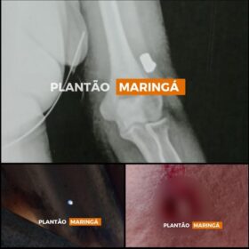 No Sarandi, bala perdida perfura teto de casa e atinge moradora de 58 anos Foto 1 Fotos de No Sarandi, bala perdida perfura teto de casa e atinge moradora de 58 anos