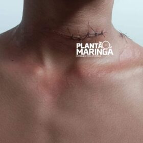 Mulher e criança ficaram feridas com linha de pipa em Sarandi Foto 2 Fotos de Mulher e criança ficaram feridas com linha de pipa em Sarandi