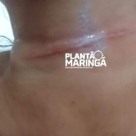 Mulher e criança ficaram feridas com linha de pipa em Sarandi Foto 3 Fotos de Mulher e criança ficaram feridas com linha de pipa em Sarandi