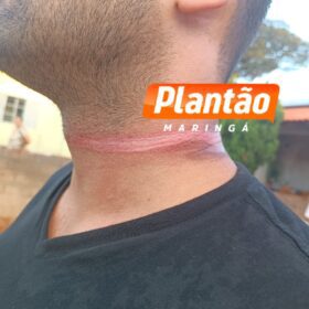 Motociclista fica ferido após acidente com fios soltos em Maringá Foto 3 Fotos de Motociclista fica ferido após acidente com fios soltos em Maringá