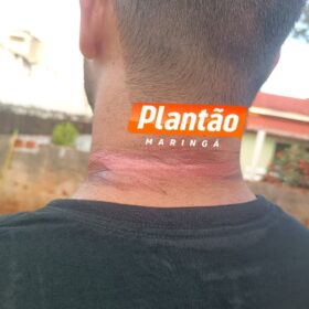 Motociclista fica ferido após acidente com fios soltos em Maringá Foto 4 Fotos de Motociclista fica ferido após acidente com fios soltos em Maringá