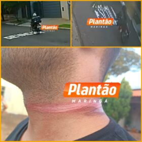 Motociclista fica ferido após acidente com fios soltos em Maringá Foto 2 Fotos de Motociclista fica ferido após acidente com fios soltos em Maringá