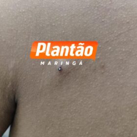 Jovem é baleado no peito enquanto andava de moto elétrica em Sarandi Foto 5 Fotos de Jovem é baleado no peito enquanto andava de moto elétrica em Sarandi
