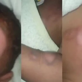 Bebê que sofreu queimaduras durante banho em creche de Sarandi deixa hospital após seis dias internado Foto 2 Fotos de Bebê que sofreu queimaduras durante banho em creche de Sarandi deixa hospital após seis dias internado
